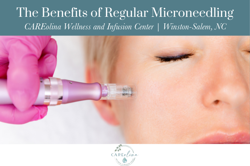 The Benefits of Regular Microneedling